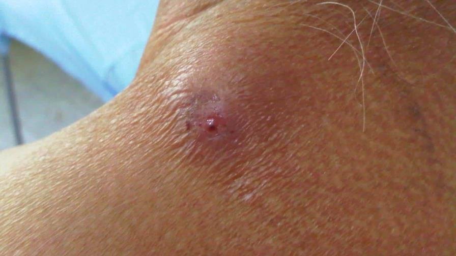 ¿Cómo se contagia el gusano barrenador?