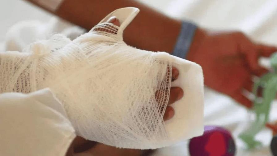 El fuego no apagó su vida, pero sí su sonrisa y su alegría