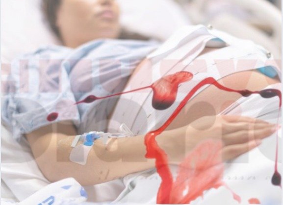 La OMS emite una guía para reducir las 45.000 muertes anuales por hemorragia posparto La OMS emite una guía para reducir las 45.000 muertes anuales por hemorragia posparto