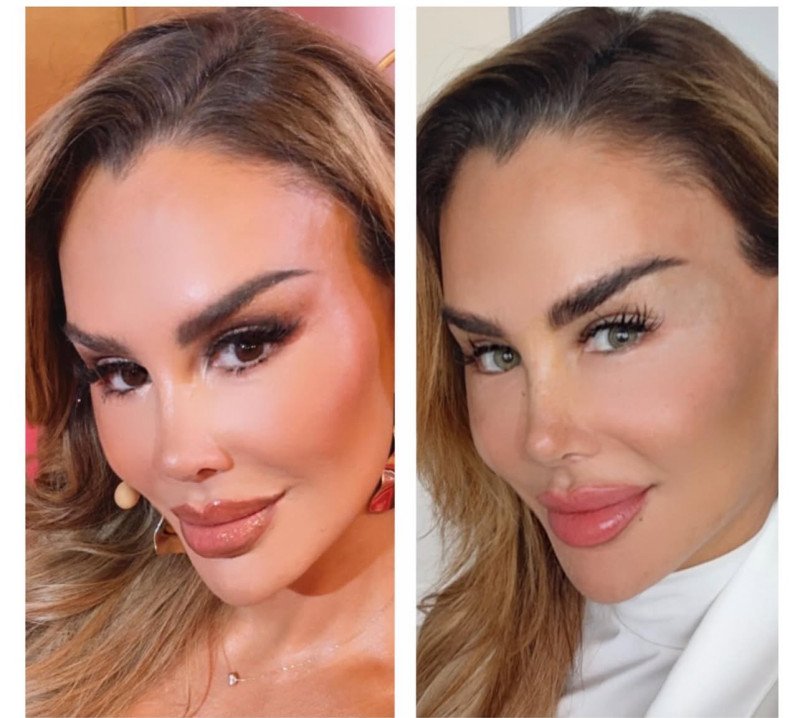 Ninel Conde se somete a procedimiento para cambiar el color de sus ojos Ninel Conde se somete a procedimiento para cambiar el color de sus ojos