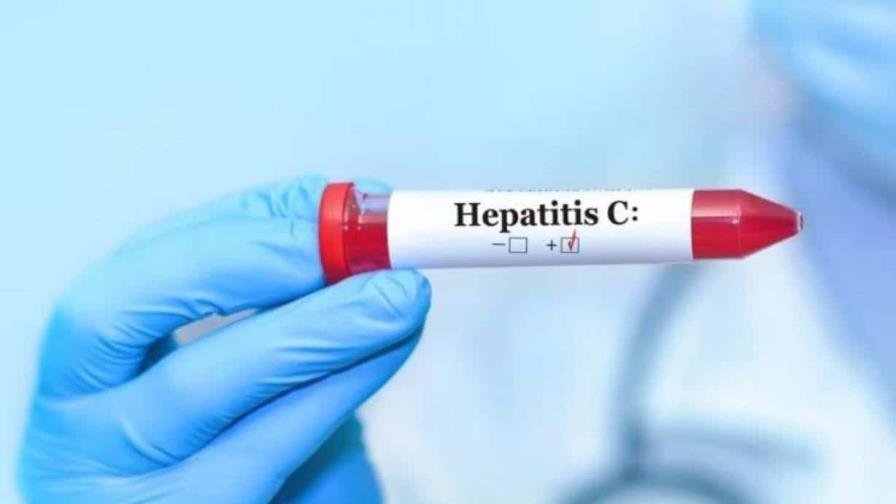Salud Pública reporta 812 casos de hepatitis C, con mayor incidencia en mujeres