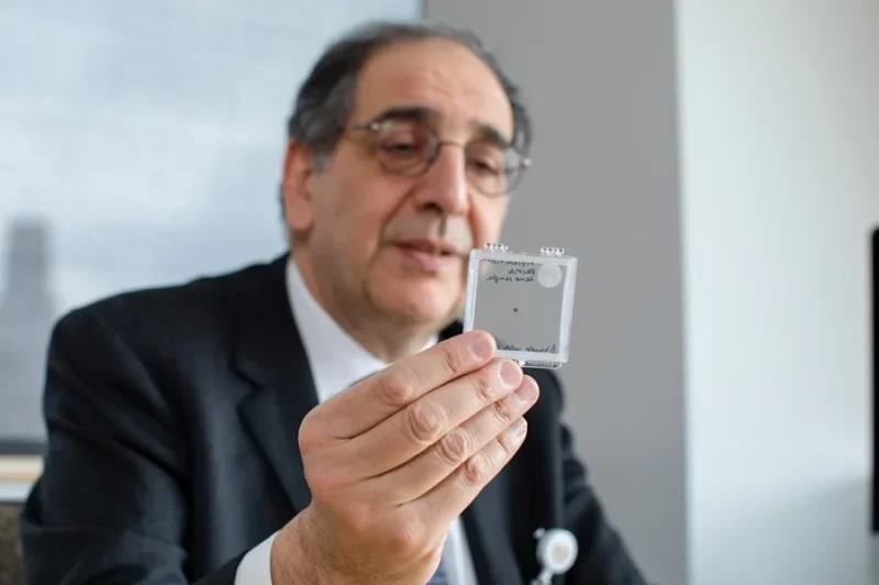 Una prótesis ocular permite leer a personas con ceguera irreversible Una prótesis ocular permite leer a personas con ceguera irreversible