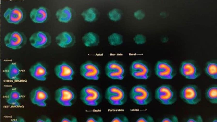 Cedimat realiza la primera gammagrafía cardíaca con Regadenoson