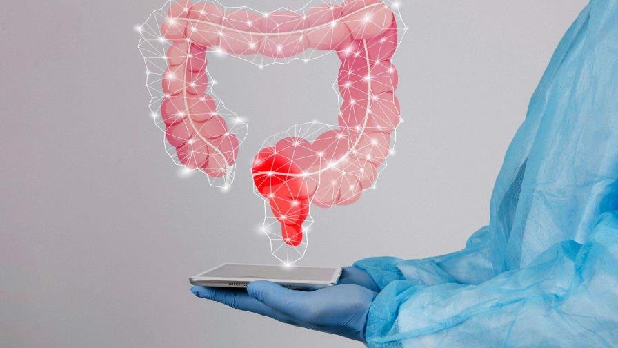 El cáncer colorrectal se protege de la inmunoterapia con un doble escudo, según un estudio