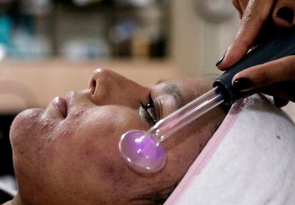 Vinculan el lupus con un virus que casi todos los humanos portan