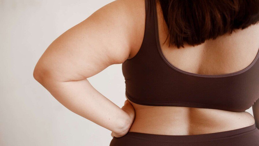 La Obesidad: Una Realidad Seria que Va Más Allá del Peso