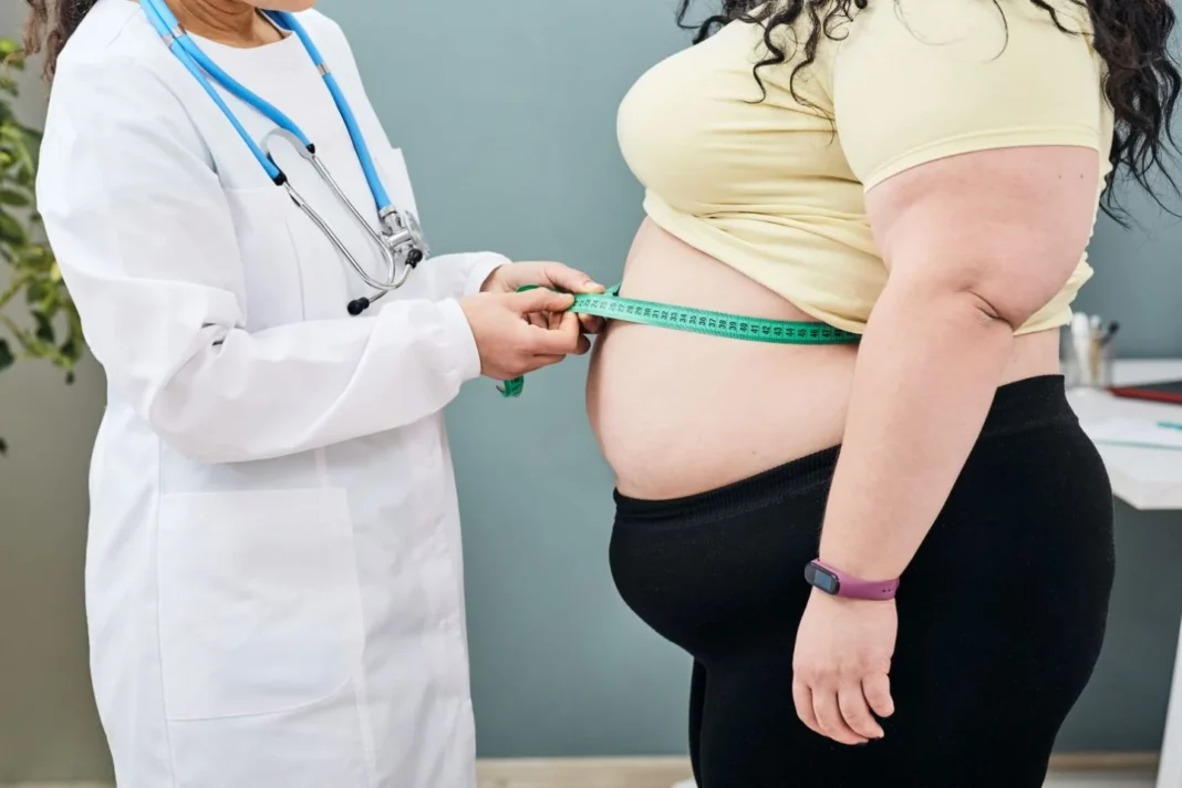 Diputados aprueban inclusión de cirugía bariátrica en Seguro Familiar de Salud