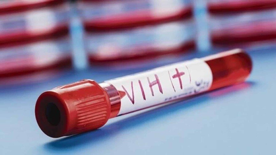 La lucha contra el VIH: ¡’Klk’ con los recortes internacionales! La lucha contra el VIH: Recortes internacionales