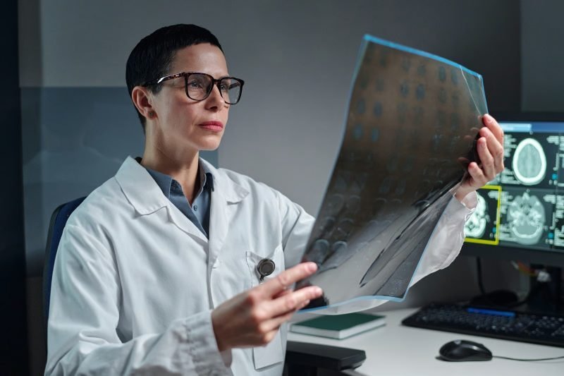 ¡No es un ‘relajo’!: Tumores cerebrales benignos también dan su ‘vaina’ Tumores cerebrales benignos pueden ser peligrosos