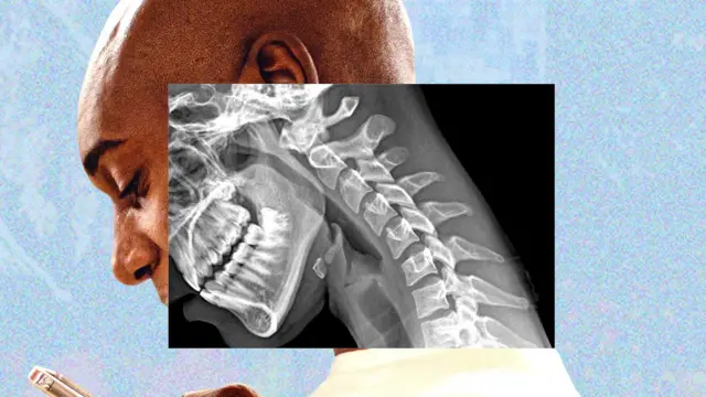 El ‘Cuello Tecnológico’ y otras vainas: ¡el celular nos está doblando! El Cuello Tecnologico y otras vainas el celular nos esta doblando