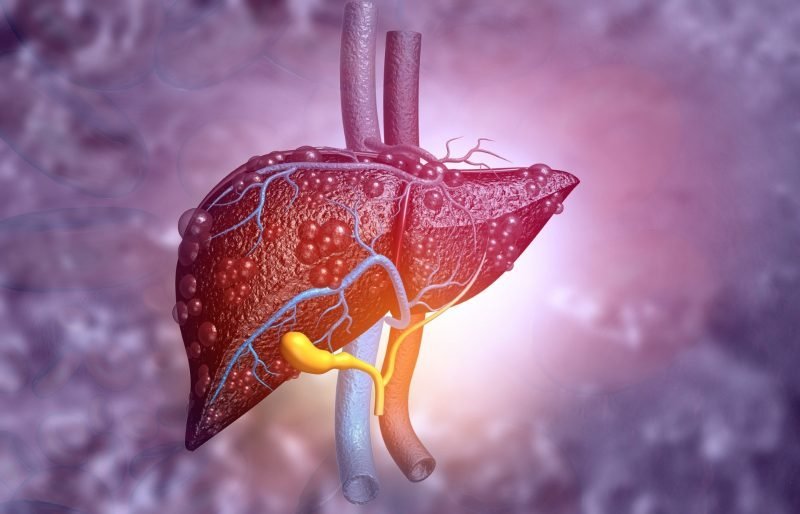 Hepatitis C: ¡Atento, mi gente! Hay cura y es un ‘bacano’ avance Hepatitis C: Cura y Avance Medico