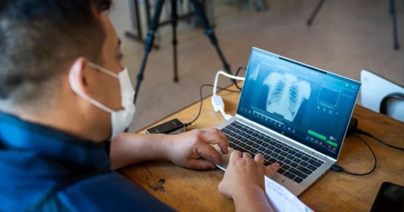 Herramientas Digitales Abren Nuevas Rutas contra la Tuberculosis