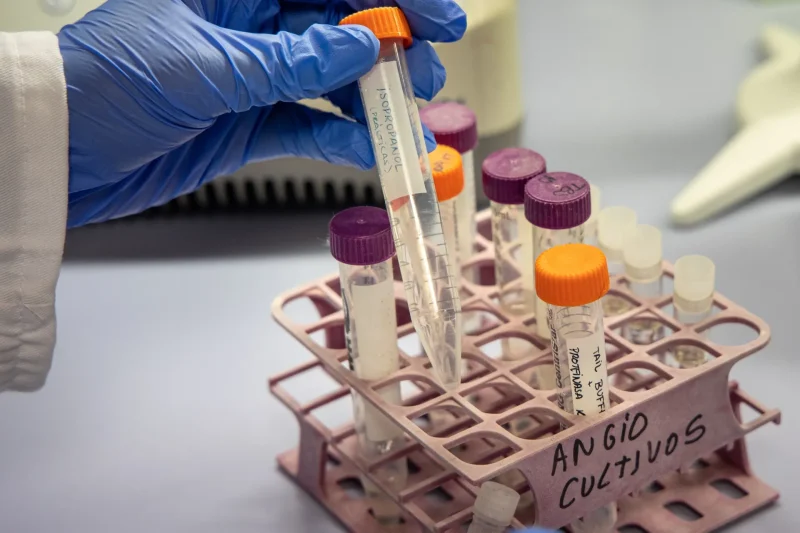 ¡Qué ‘vaina’ buena! Terapia Génica promete freno al Alzhéimer: un ‘palo’ para la ciencia Que vaina buena! Terapia Genetica promete freno al Alzheimer un palo para la ciencia