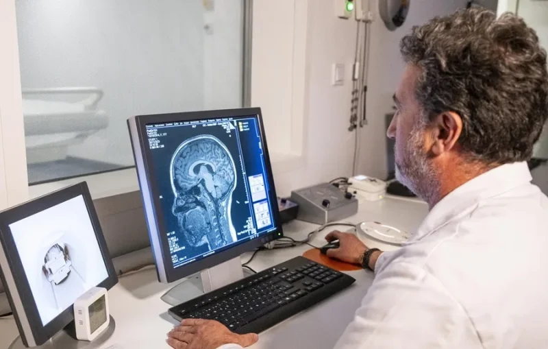 El Parkinson en Europa: Una Enfermedad Costosa para la Salud