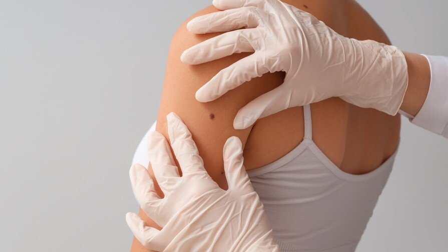 ¡Qué Nivel! Vacuna Contra el Cáncer de Piel Podría ser una ‘Vaina’ Súper Bacana Vacuna Contra el Cáncer de Piel de Moderna y Merck Muestra Resultados Prometedores