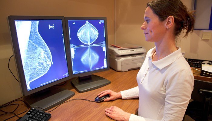 Mamografía: ¡No hagas esa ‘chercha’ de posponerla, que es por tu salud! Mamografía: No postergue su mamografía, es por su salud.