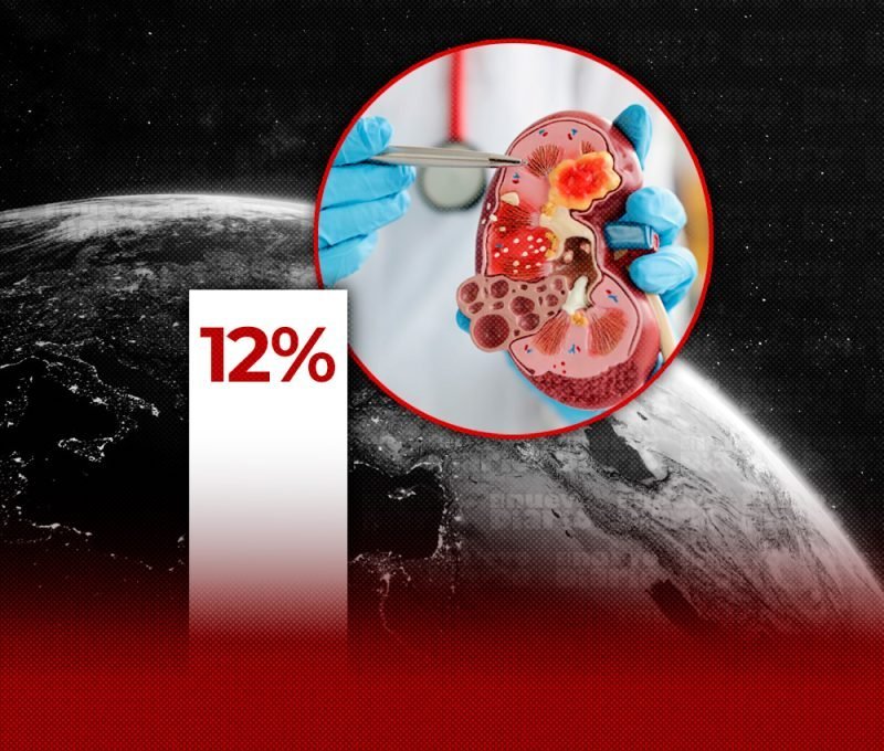 ¡Atención, mi gente! Infecciones y Cáncer: un ‘Coro’ Peligroso que nos Toca a Todos Infecciones y Cáncer: un Problema Mundial que nos Toca a Todos