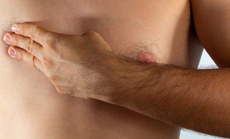 Cáncer de mama masculino: ¡No es ‘vaina’ de mujeres, tigueres! Cáncer de mama masculino: la verdad que los hombres deben saber