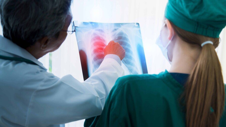 ¡Qué Vaina Bacana! La Detección Temprana del Cáncer de Pulmón puede Salvar Vidas, Asegún el Caso del Papa La Detección Temprana del Cáncer de Pulmón puede Salvar Vidas, según el Caso del Papa