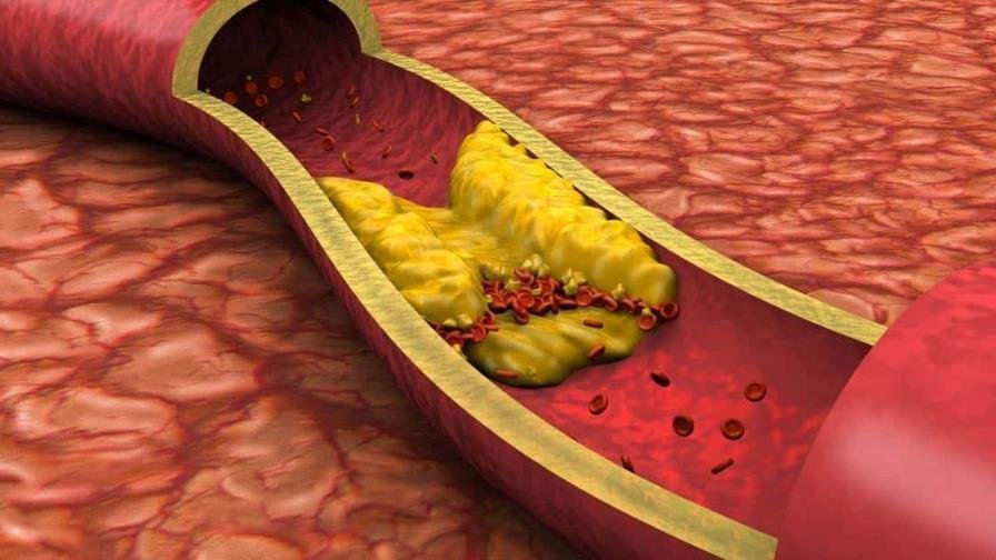 ¡Atención, mi gente! No te dejes con las ‘señales ocultas’ de enfermedades vasculares Atención, mi gente! No te dejes con las señales ocultas de enfermedades vasculares